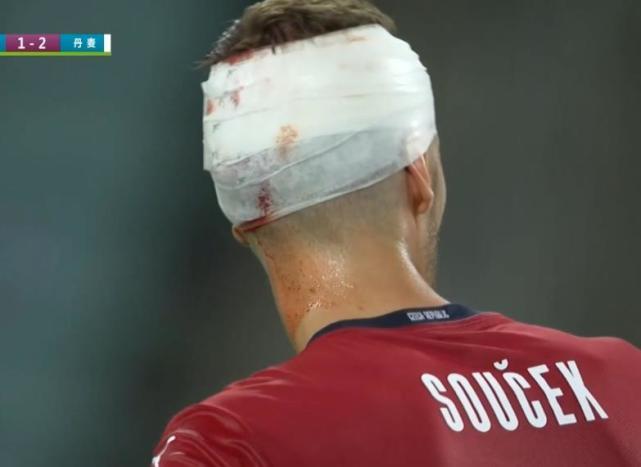 欧洲杯受伤头戴绷带（欧州杯受伤球员）